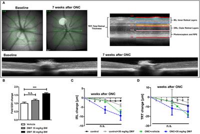 Neuroprotective Properties of Dimethyl Fumarate Measured by Optical Coherence Tomography in Non-inflammatory Animal Models